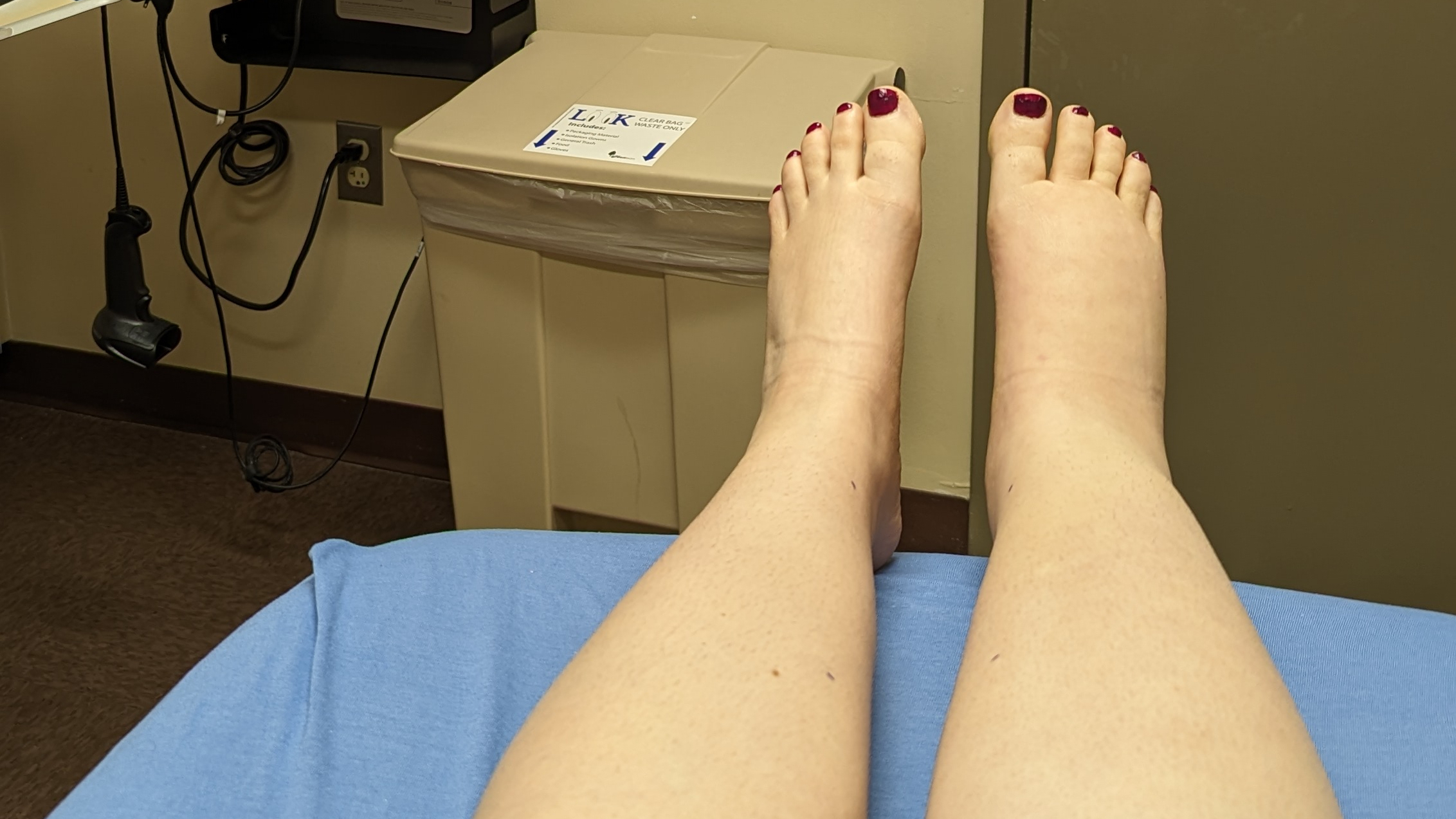 A view of Alexa's outstretched legs from her perspective while sitting on a bed in a clinic exam room.